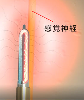 Coolief疼痛管理用高周波システムとは？