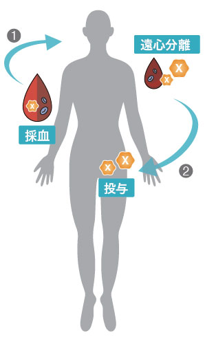 HD-PRP療法とは？